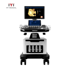 High Specification Double Screen Mobile Medical 4D Color Doppler Ultrasound Trolley Machine